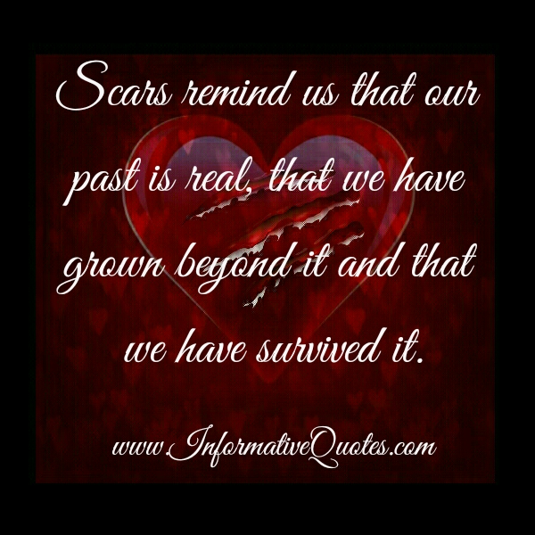 What scars remind us about? - Informative Quotes